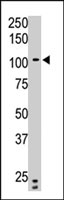 PAB4105 - PTPRN2