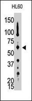 PAB4108 - PTPN5 / STEP