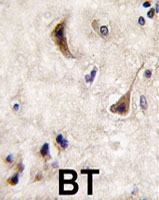 PAB4108 - PTPN5 / STEP