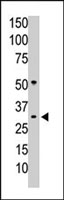 PAB4111 - PPP1CC