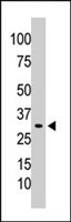 PAB4112 - PPP1CC