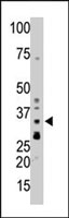 PAB4113 - PPP1CB
