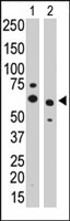 PAB4114 - Protein phosphatase 1G / PPM1G