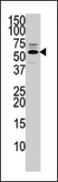 PAB4118 - PTEN