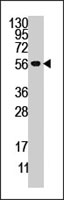 PAB4129 - DUSP4