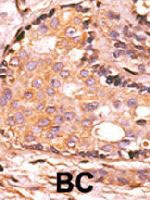 PAB4129 - DUSP4