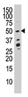PAB4136 - DUSP10 / MKP5