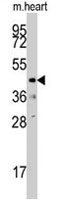 PAB4136 - DUSP10 / MKP5