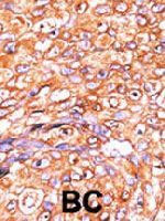 PAB4136 - DUSP10 / MKP5
