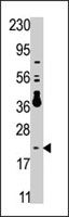 PAB4140 - DUSP13