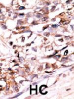 PAB4140 - DUSP13