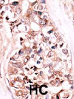 PAB4142 - DUSP14 / MKP6