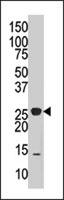 PAB4143 - DUSP14 / MKP6