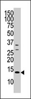 PAB4144 - DUSP15
