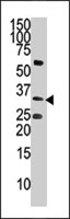 PAB4149 - CTDSP1