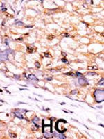 PAB4149 - CTDSP1