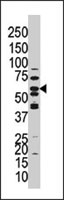 PAB4153 - PPP3CC / CALNA3