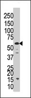 PAB4154 - PPP3CC / CALNA3