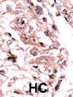 PAB4154 - PPP3CC / CALNA3