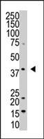 PAB4162 - DUSP1 / MKP1