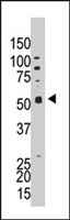 PAB4172 - PPP5C