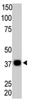 PAB4173 - PPP6C