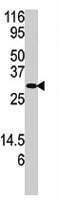 PAB4175 - DUSP3