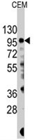 PAB4179 - PIK3CG