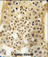 PAB4186 - USP7 / HAUSP