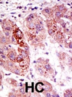 PAB4186 - USP7 / HAUSP