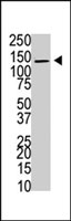PAB4187 - USP8 / UBPY