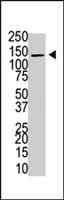 PAB4188 - USP8 / UBPY