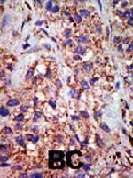 PAB4190 - USP10