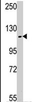 PAB4191 - USP11