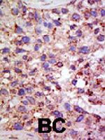PAB4191 - USP11