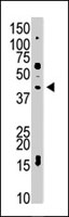 PAB4195 - USP12