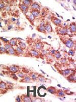 PAB4195 - USP12