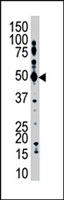 PAB4196 - USP12