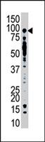 PAB4197 - USP13