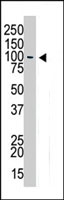 PAB4198 - USP13