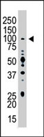 PAB4198 - USP13