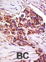 PAB4198 - USP13