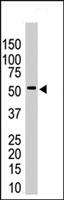 PAB4199 - USP14