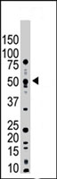 PAB4199 - USP14