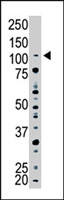 PAB4201 - USP15