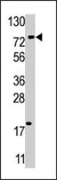 PAB4204 - USP16