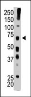 PAB4210 - USP22