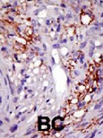 PAB4210 - USP22
