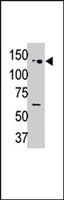 PAB4213 - USP25