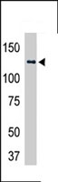PAB4214 - USP25